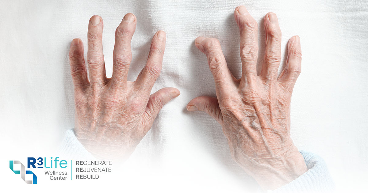 Rheumatoid Arthritis Symptoms_R3 Wellness Center