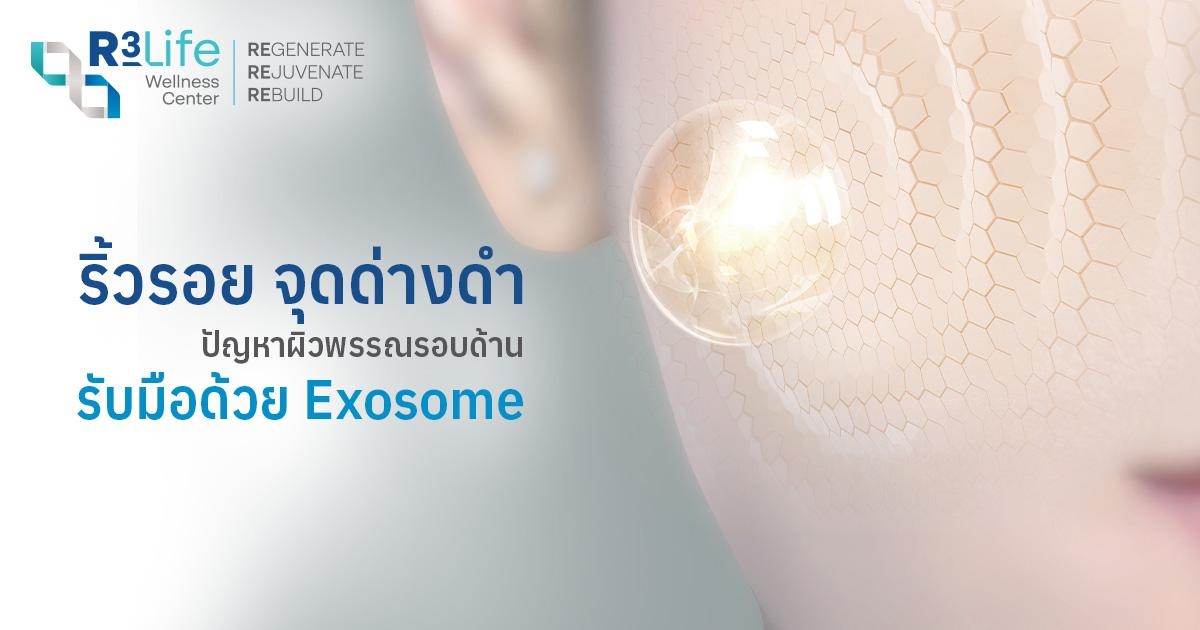 แก้ปัญหาริ้วรอย จุดด่างดำด้วย Exosome