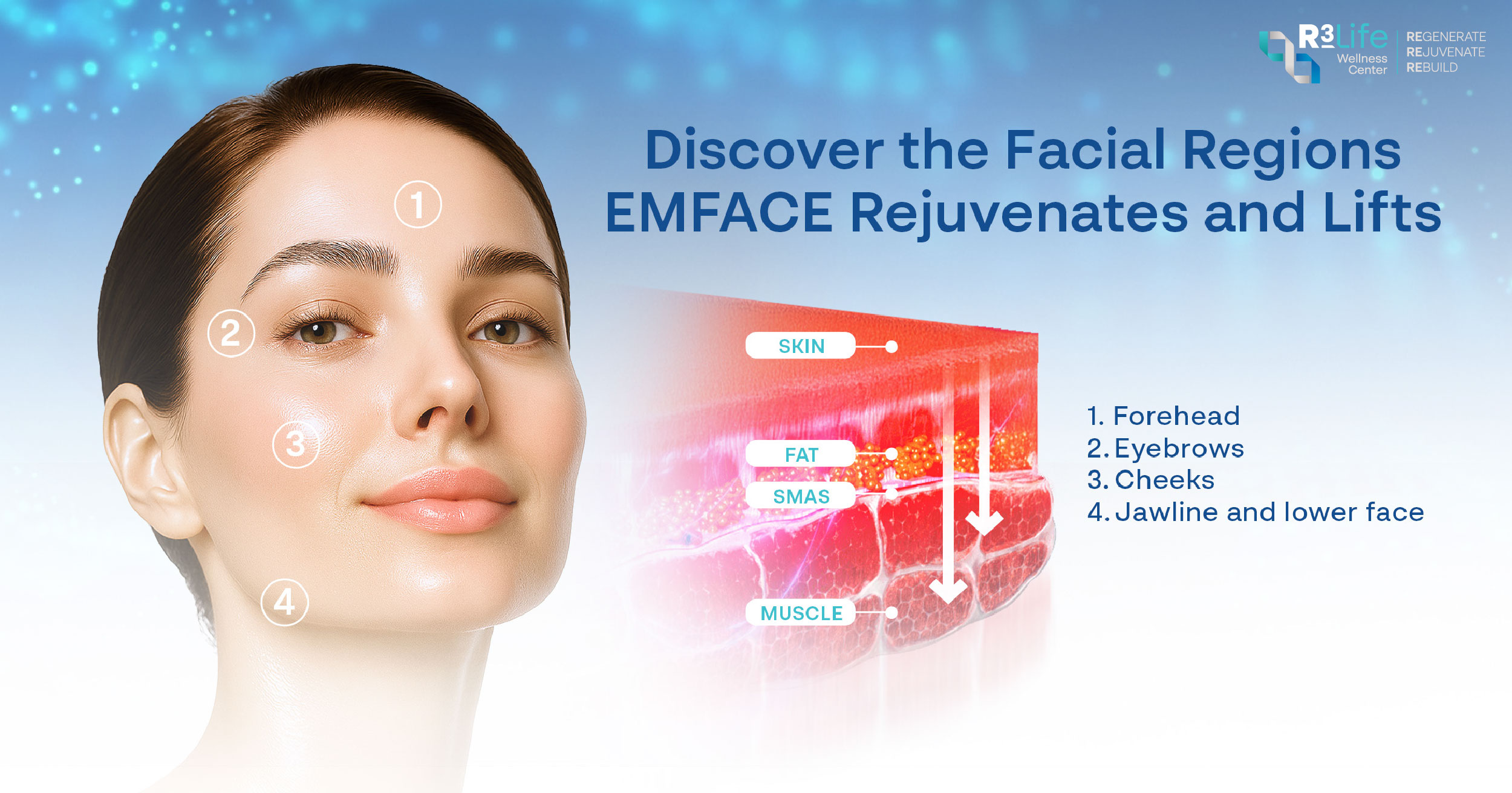 EMFACE rejuvenates and lifts forehead, eyebrows, cheeks and jawline for natural facial contouring