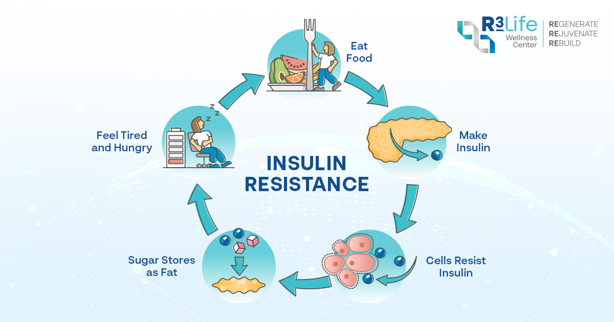 Illustration of insulin resistance and glucose metabolism in diabesity