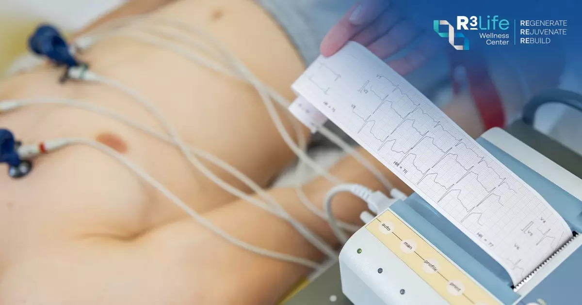 12-lead ECG test in hospital electrocardiogram procedure
