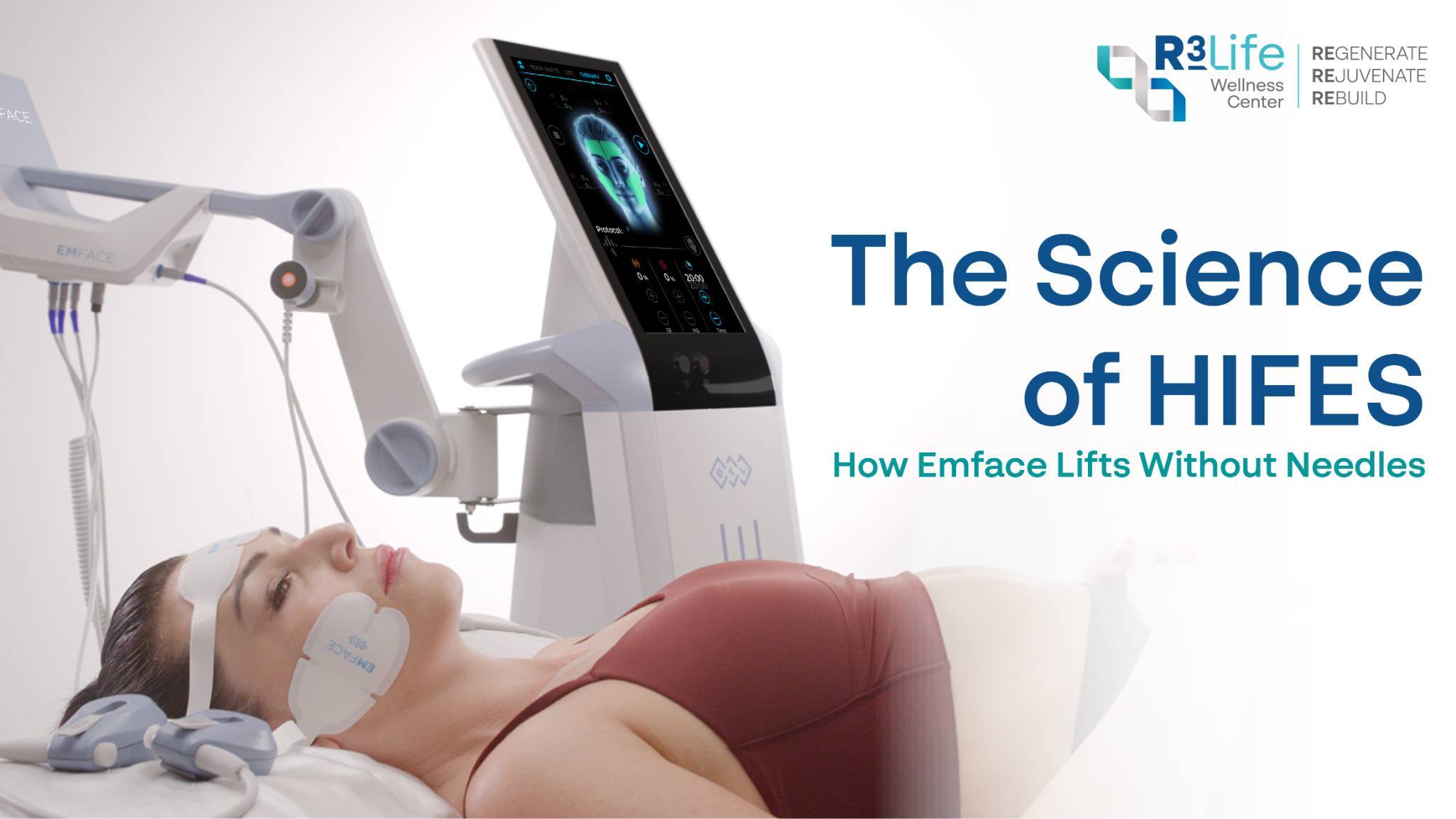 The Science of HIFES — How Emface Lifts Without Needles  1