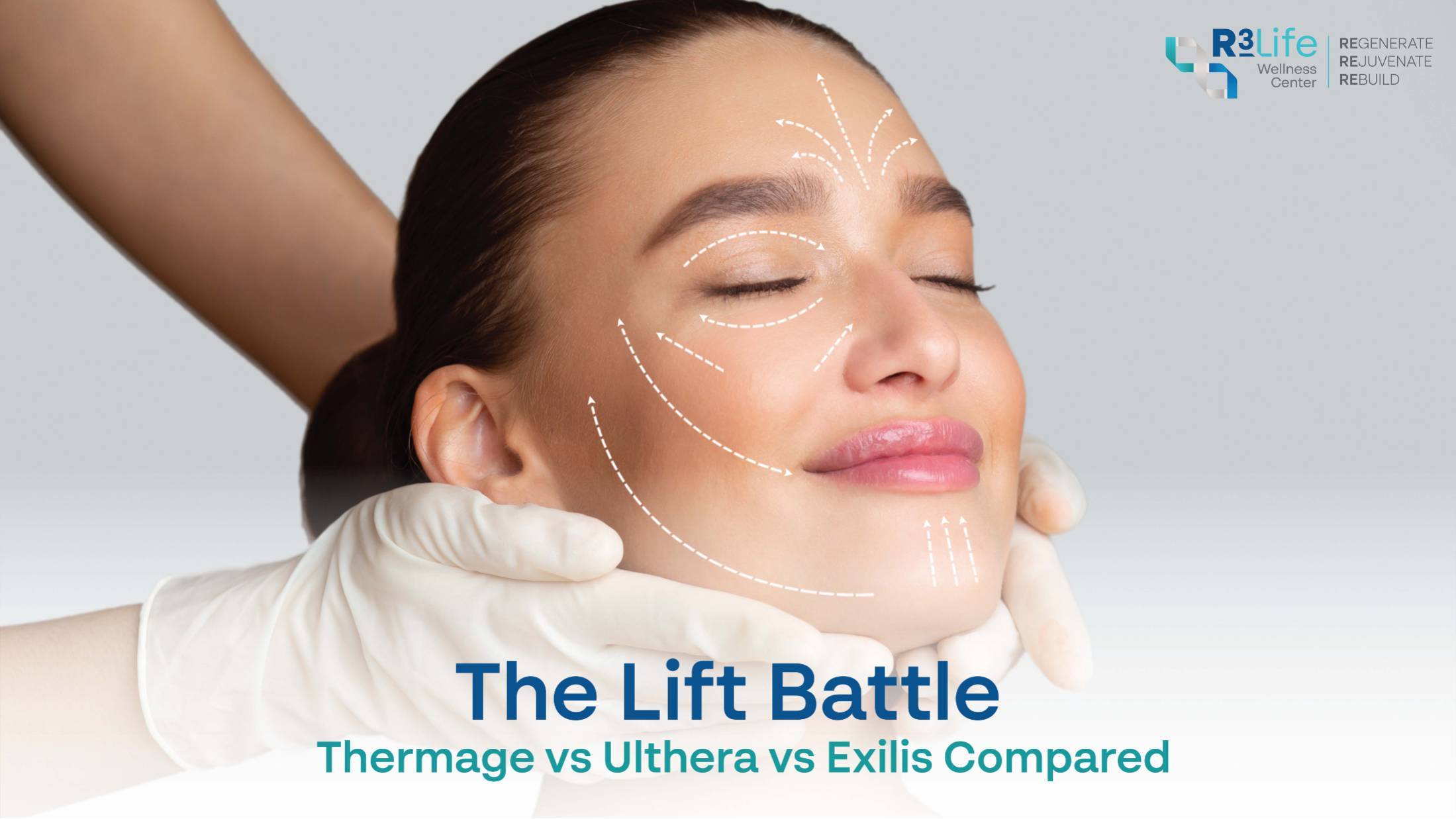 The Lift Battle: Thermage vs Ulthera vs Exilis Compared  3
