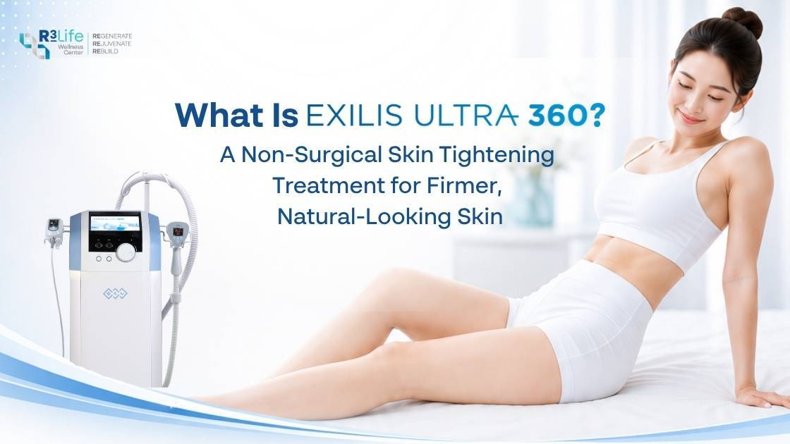 What Is Exilis Ultra 360? A Non-Surgical Skin Tightening Treatment for Firmer, Natural-Looking Skin