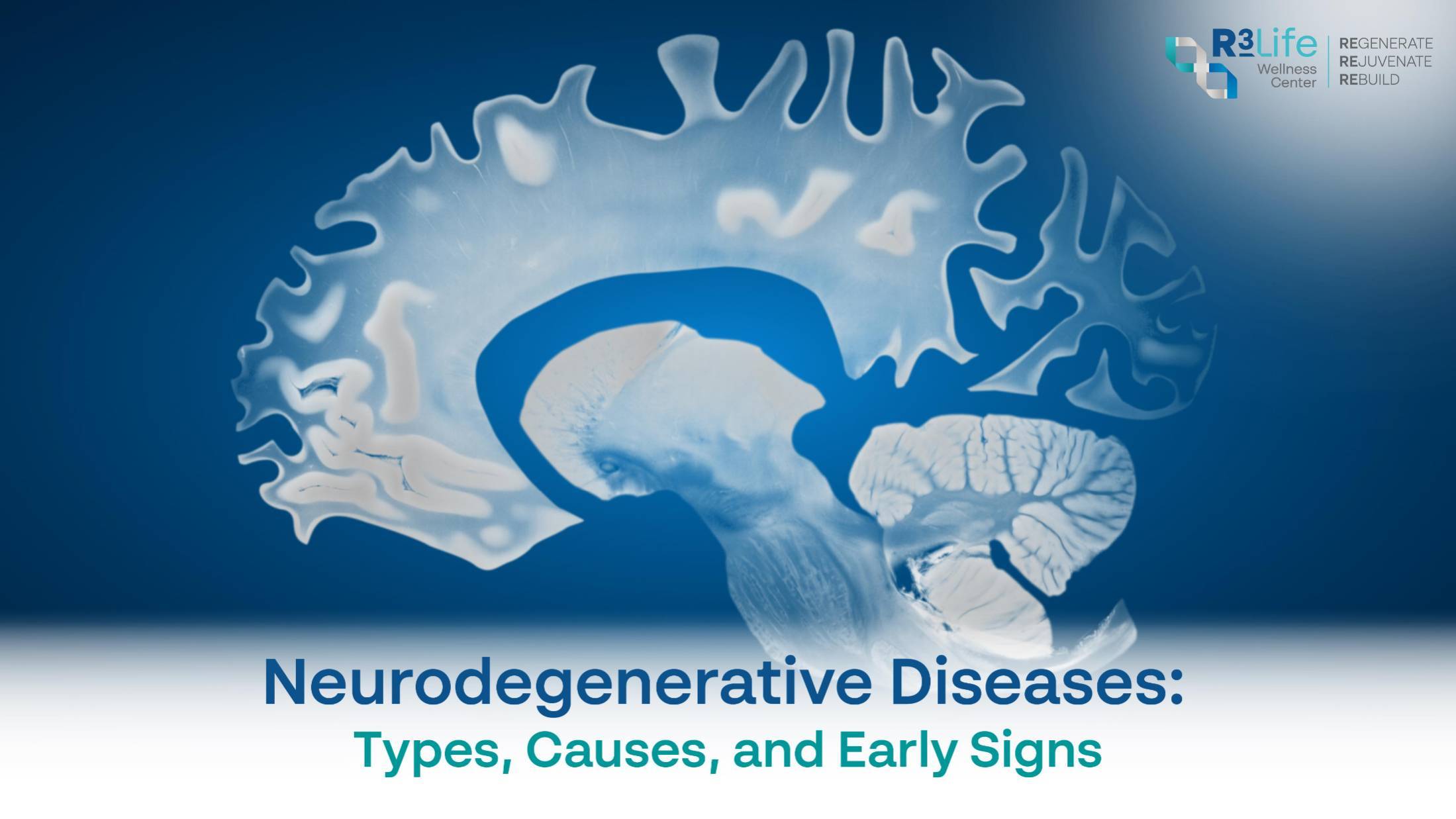 Neurodegenerative Diseases: Types and Early Signs  1