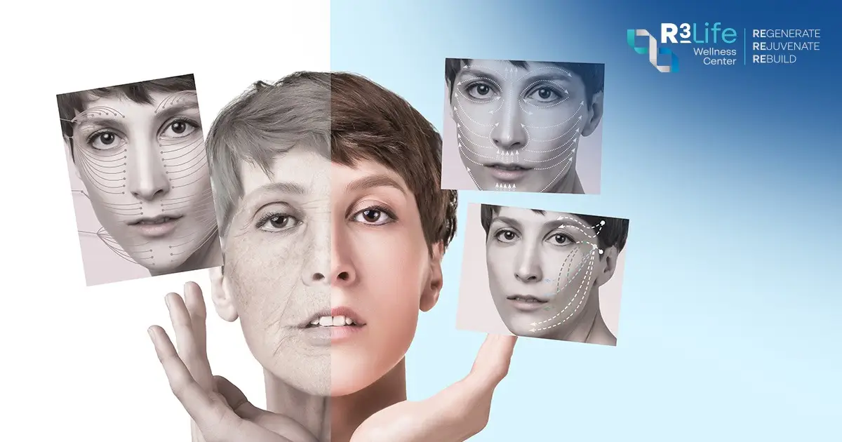 Facial aging changes including wrinkles, volume loss, and skin laxity that may require different treatments