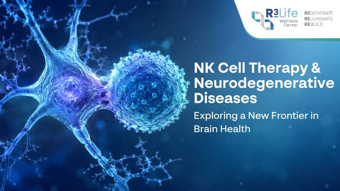 NK Cell Therapy and Neurodegenerative Diseases: Exploring a New Frontier in Brain Health  1