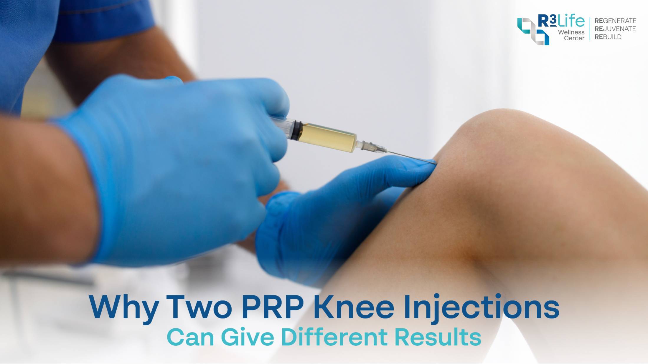Why Two PRP Knee Injections Can Give Different Results  1