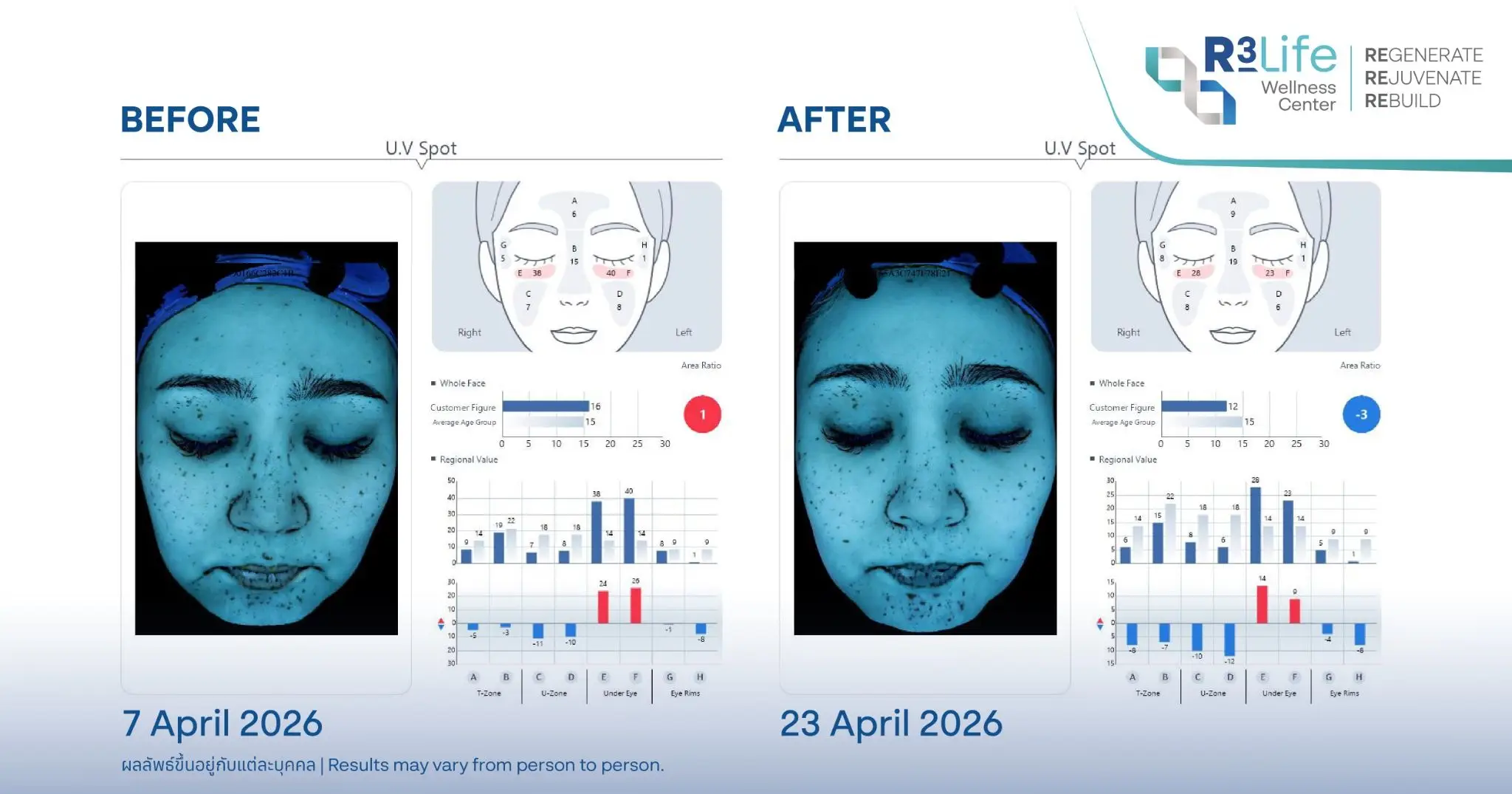 ผล Face Scan ก่อนและหลัง Pure Glow Essence 3 ครั้ง ค่า U.V Spot ลดจาก 16 เป็น 12 ระหว่างวันที่ 7–23 เมษายน 2026