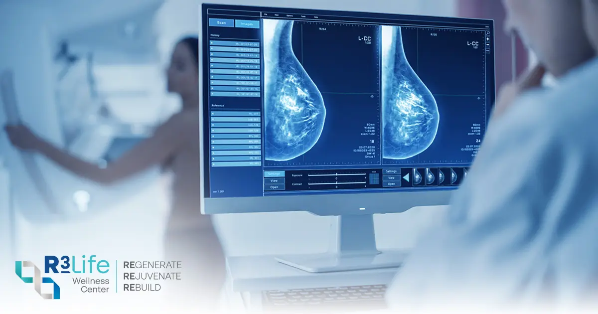 When Should You Get Breast Cancer Screening
