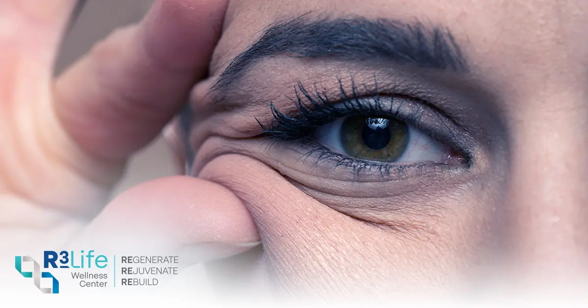 Improve an Aging Face