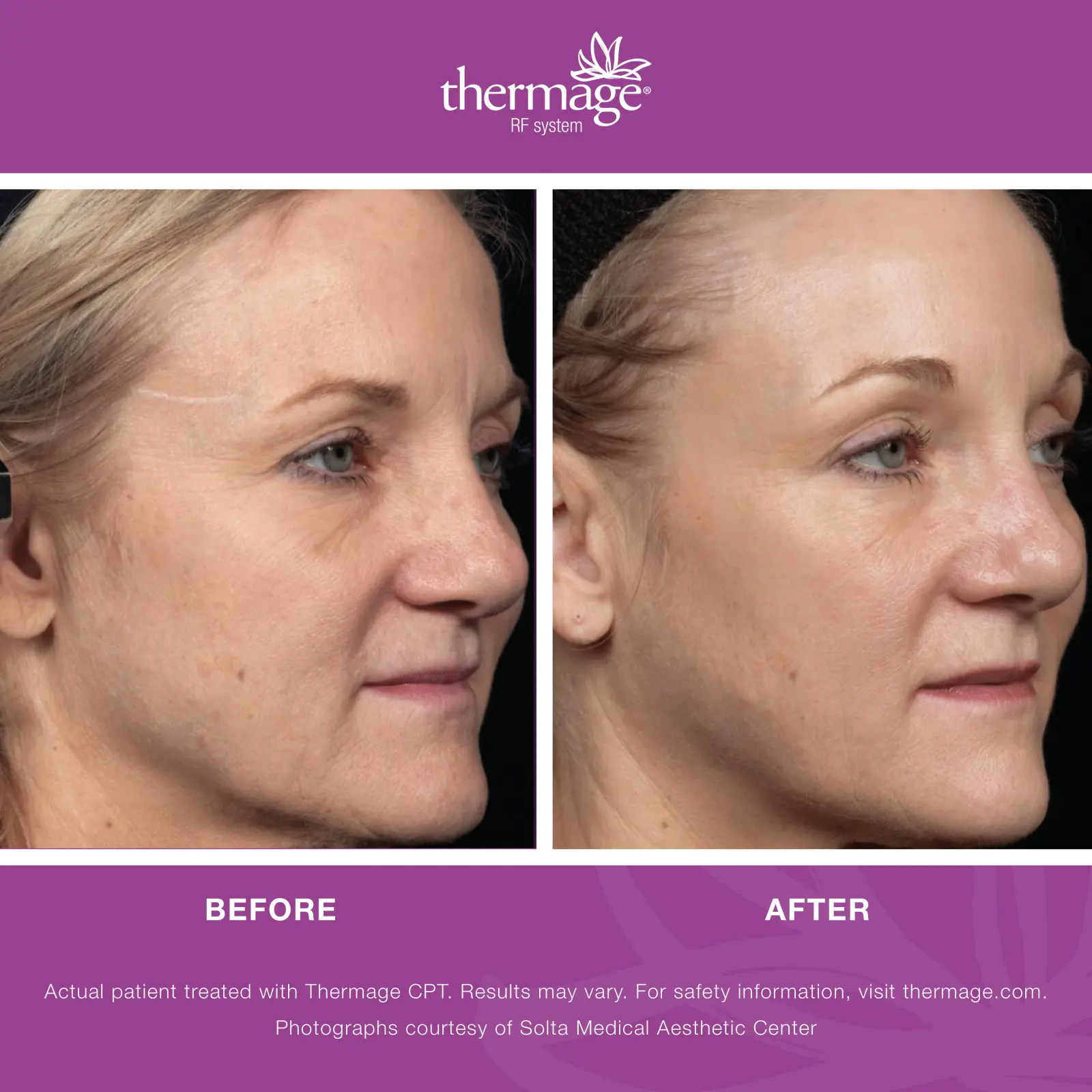 collagen booster results