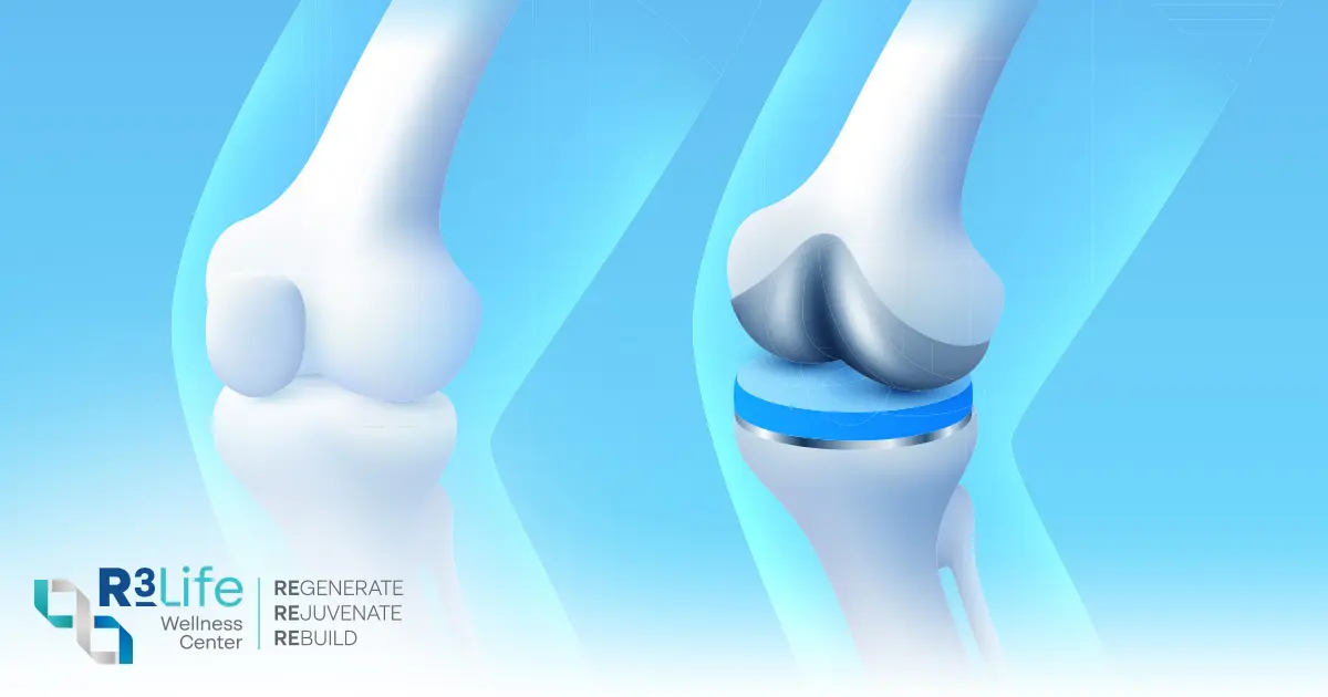 Knee Problems and Why They Occur