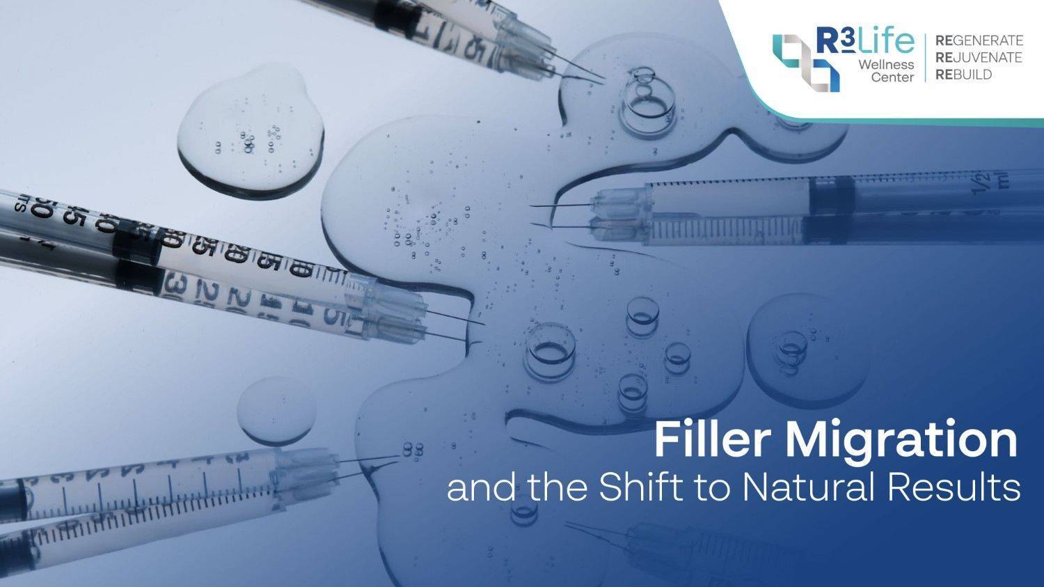 Filler Migration: Why Filler Moves and What Helps  2