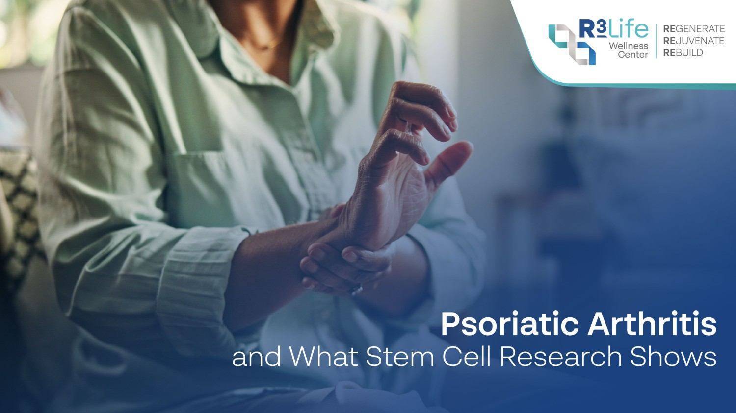 Psoriatic Arthritis and What Stem Cell Research Shows  2